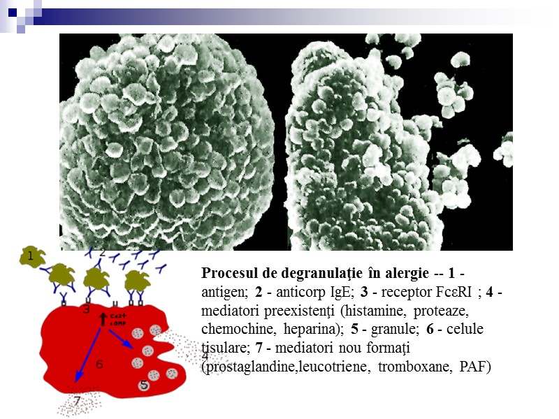 Procesul de degranulaţie în alergie -- 1 - antigen; 2 - anticorp IgE; 3